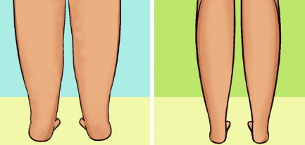 발부종 좋아지는 단순한 방법