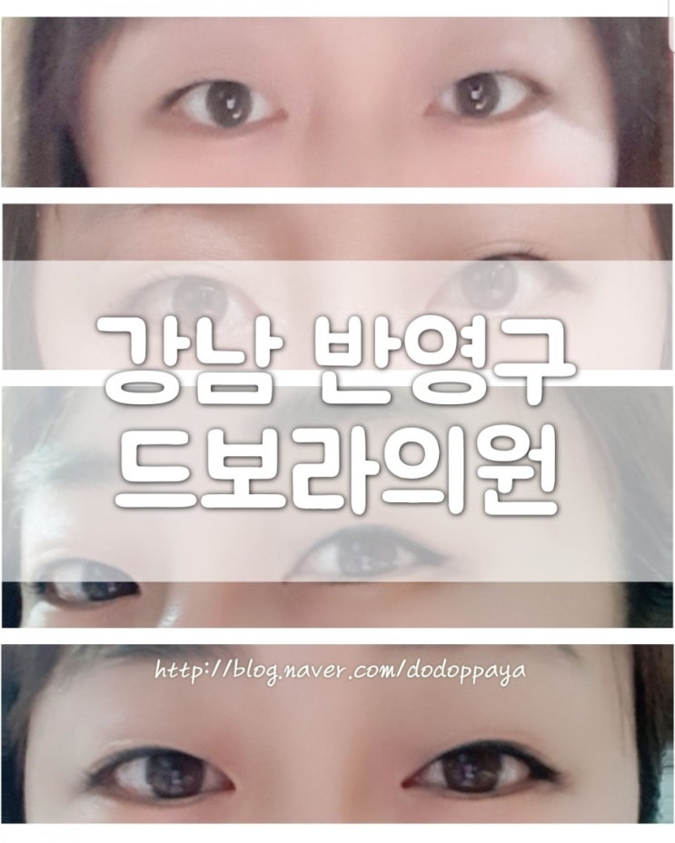  강남눈썹문신 드보라의원에서 아이라인 1차 완료