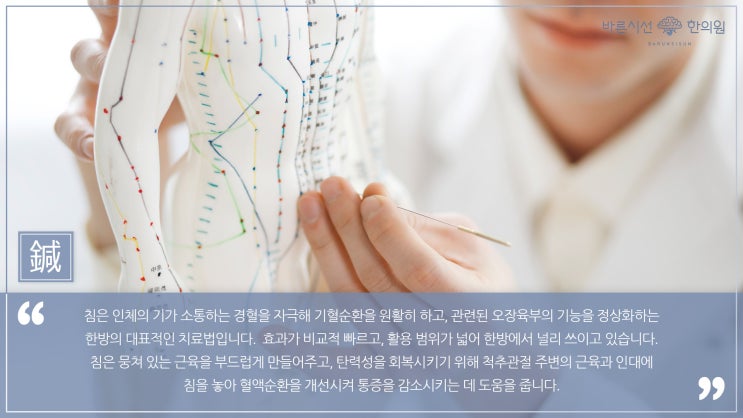  [일산 침 잘놓는 한의원] 침의 원리와 효능, 종류에 대해 알아보자