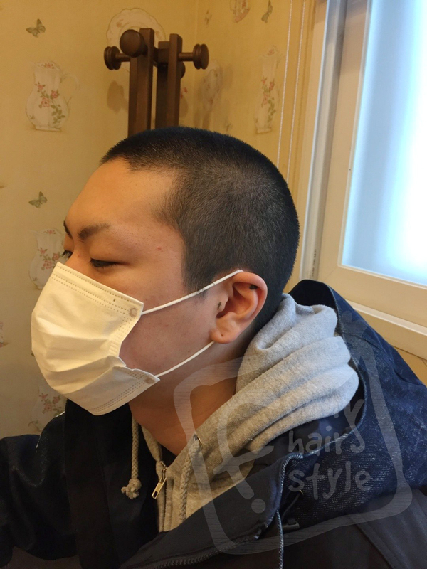  홍대 혁오밴드 정품 퍼니T 남자 탈모 오혁 스티커 붙임 머리 증모술