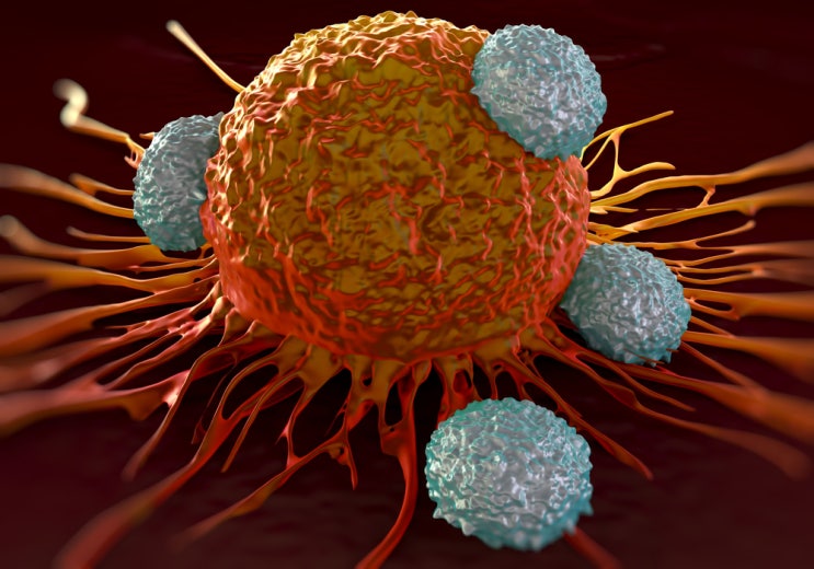 흑색종(Melanoma)에서 면역치료 요법 (Immunotherapy) 반응성을 높이는 새로운 접근법 발견