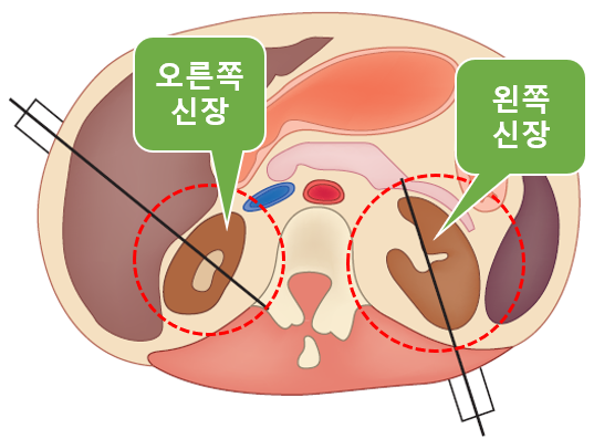  2020년 신장 초음파 건강보험 적용 비용