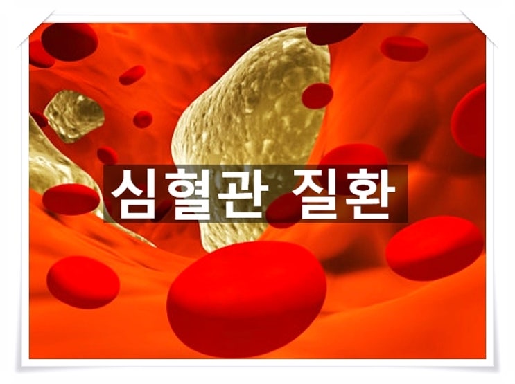  침묵의 살인자 '심혈관질환'에 좋은 음식과 나쁜음식