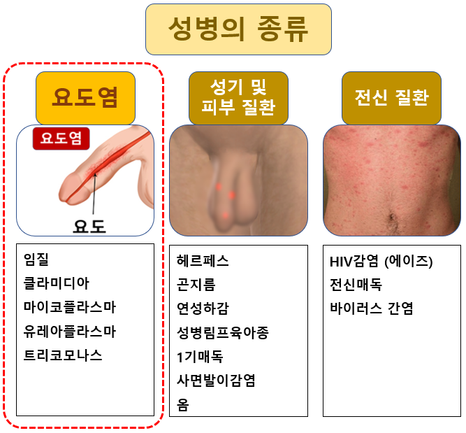 가능한 한 빨리 요도염 검사를 받는 것이 중요합니다.