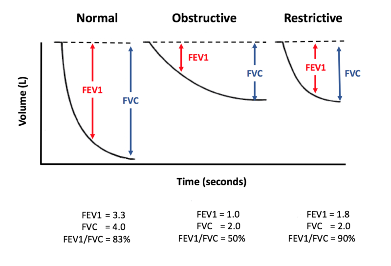 1-pft