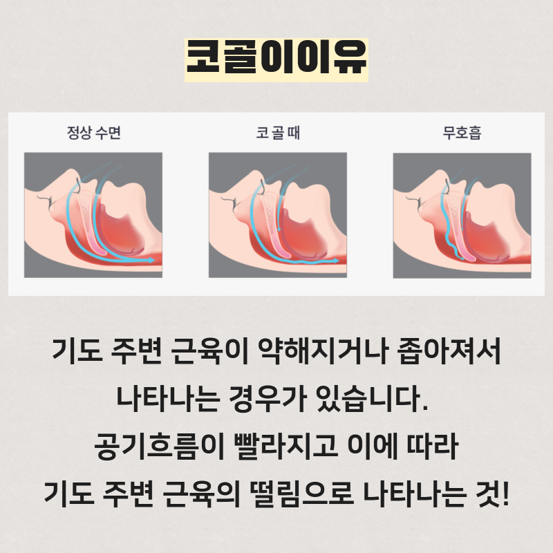 코골이의 원인과 예방