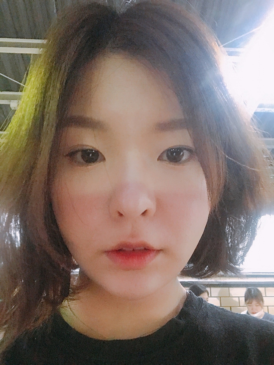  실리프팅잘하는병원 기대했던 만큼