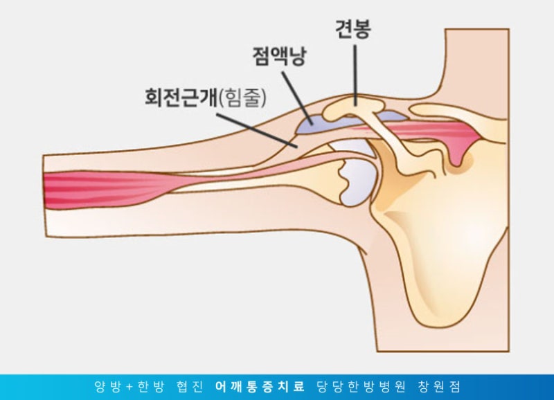 오른쪽 어깨 통증, 회전근개파열 증상과 원인, 수술 치료(재활 병원, 운동 방법) 9