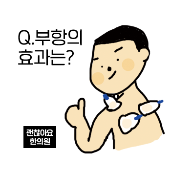 부항 효과. 부항은 어떤 효과가 있나요? 부황 효과 부항 효과. 부항은 어떤 효과가 있나요? 부황 효과