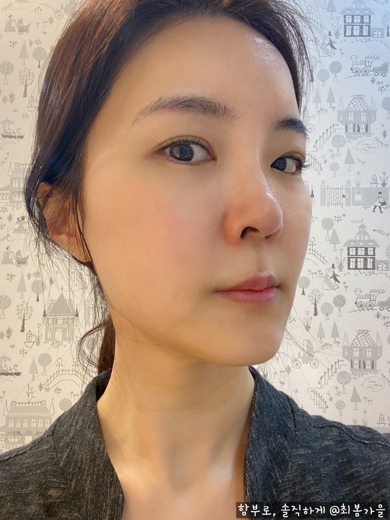 얼굴 색소침착으로 관리가 필요한 지금 류스파 9