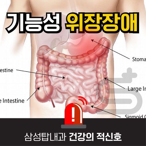 편두통 해법/두통 구토 증상 해결/약 없이 편두통 이기다 12