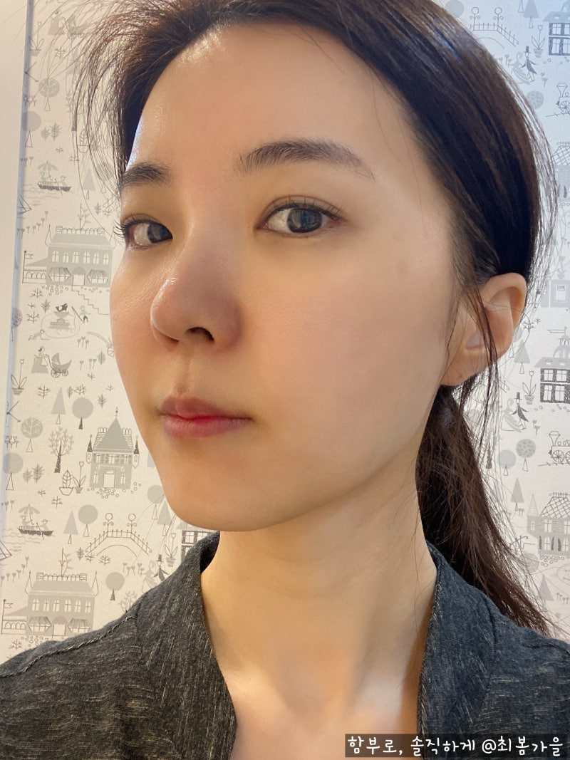얼굴 색소침착으로 관리가 필요한 지금 류스파 6
