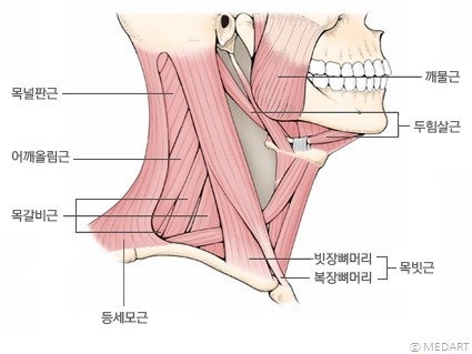 왼쪽 및 오른쪽 부위에서 목 및 허리 통증의 근본 원인을 특정.