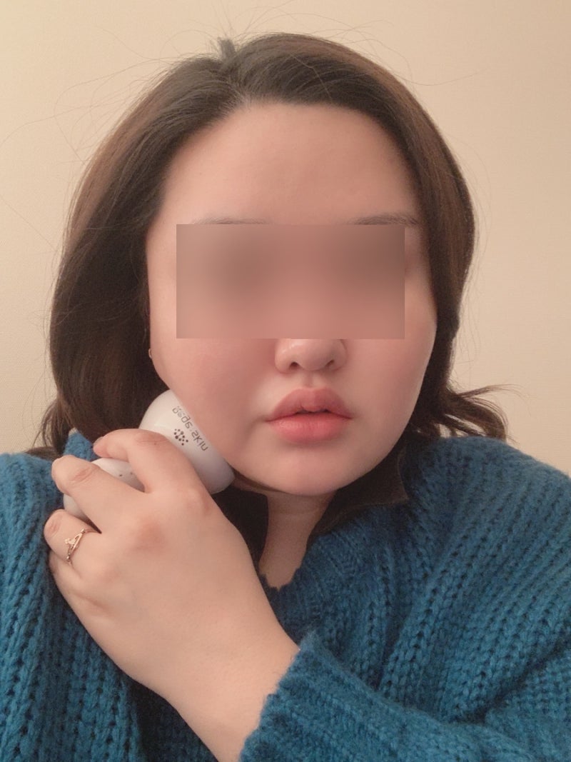 효도성형 어머니 침샘 보톡스 리뷰 1년째 관리중! (feat. 내돈내산)