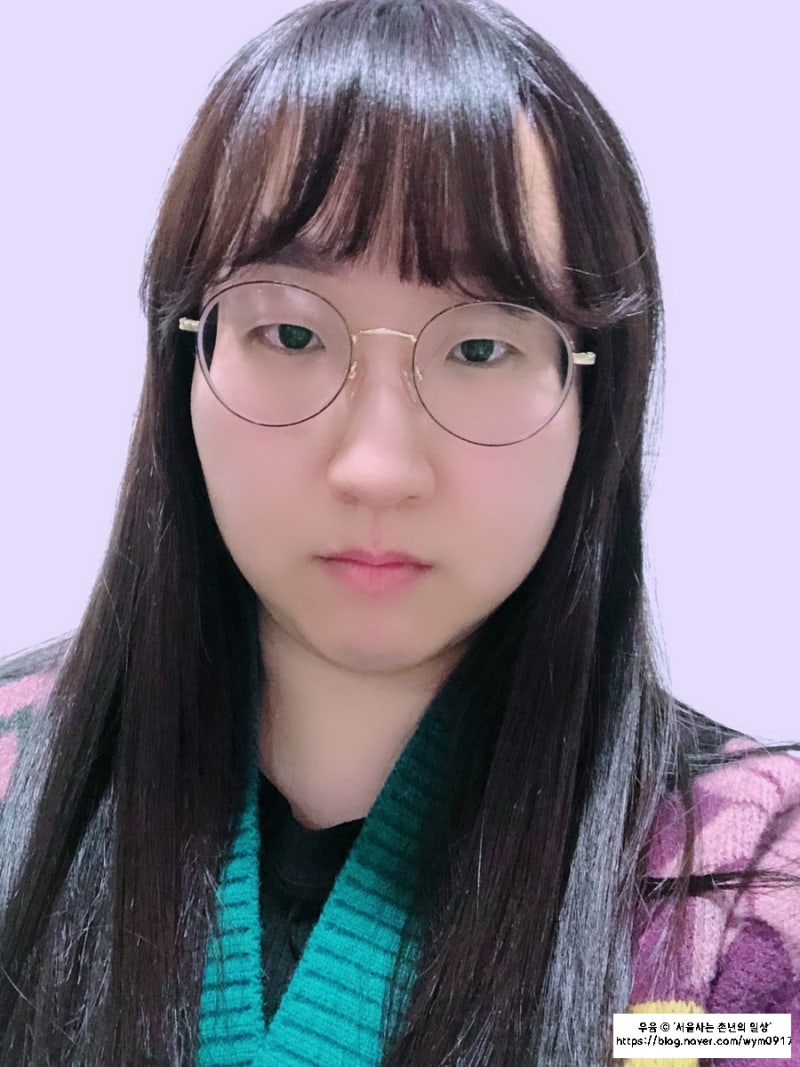 쌍수 당일 후기(완전절개+앞+뒤트임+안검하수+지방제거) : 네이버 블로그 쌍수 당일 후기(완전절개+앞+뒤트임+안검하수+지방제거) : 네이버 블로그