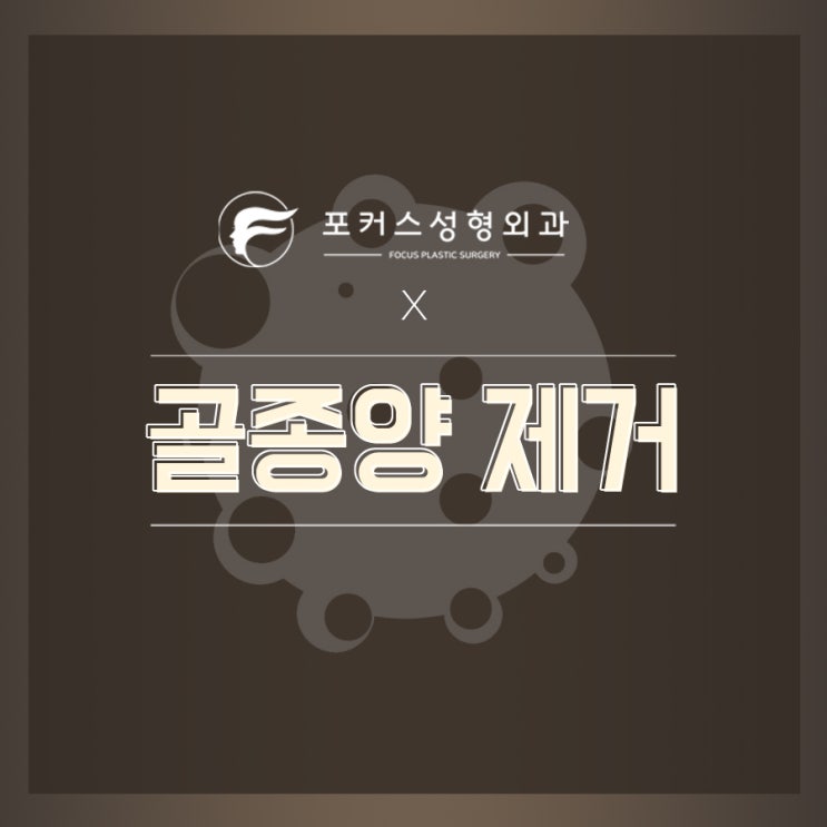 광대 골종 제거 광대 골종 제거
