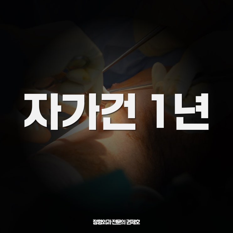  전방십자인대 파열로 인한 재건술 reconstruction 1년 변화