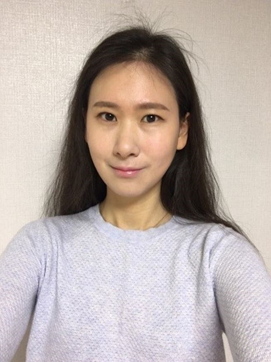  실루엣소프트리프팅 마음에 들어요