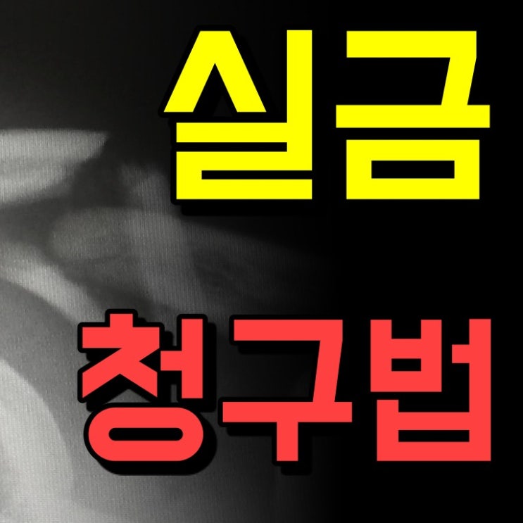  골절진단금 후유장해 모르는 사람 너무 많다