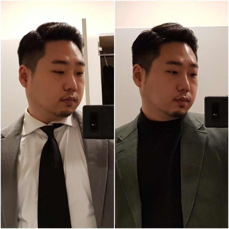장성규 슈링크, 남자도 리프팅이 필요해 500샷!