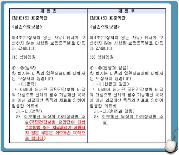 하지정맥류수술비용보험혜택을확인해주세요.