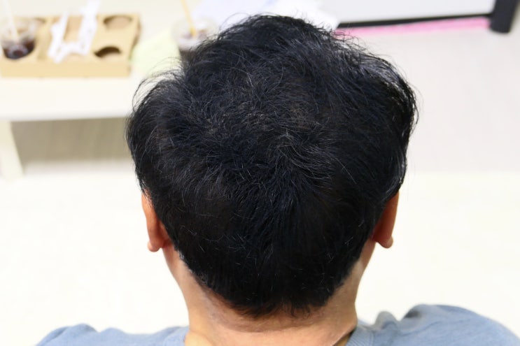  흑채추천 여성흑채로도 유명한 블랙모아