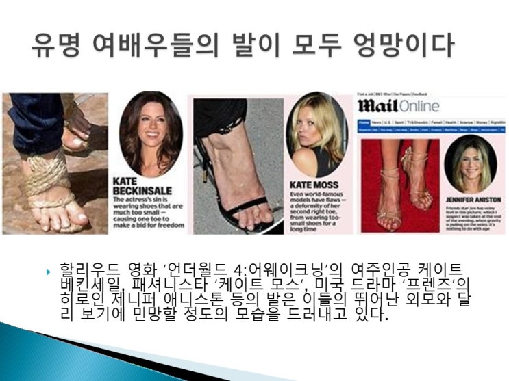  무지외반증 교정 건강에 진짜 좋은 편한 기능성신발 24HRS