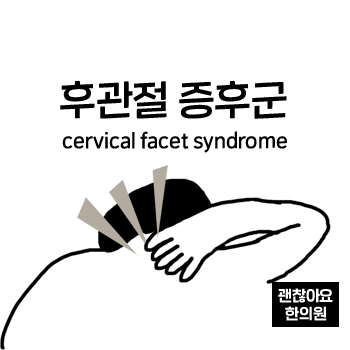 후관절 증후군. 목 어깨가 아파요 ③ 후관절 증후군. 목 어깨가 아파요 ③