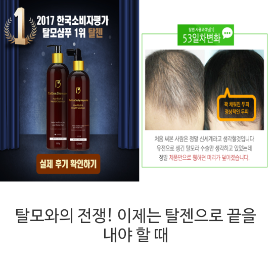  탈모와의 전쟁! 이제는 탈젠으로 끝을 내야 할 때