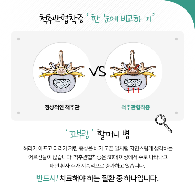 교대정형외과와 알아보는 척추관협착증
