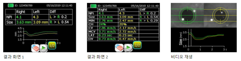 NPI-200 (동공측정기) NEUROPTICS Pupillometer System : 네이버 블로그