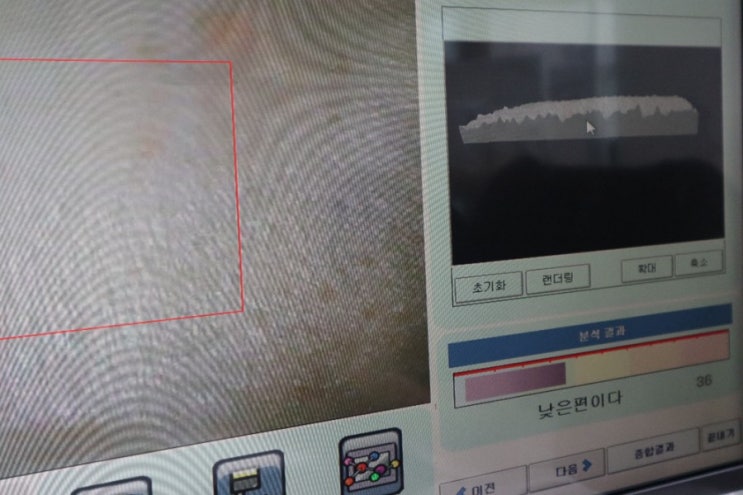  [화곡동피부관리]'제일에스테틱'-강서구 등관리 잘하는 피부관리샵 추천해요