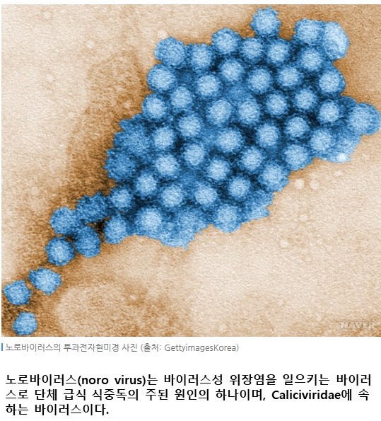  노로바이러스 백신 개발은 언제쯤