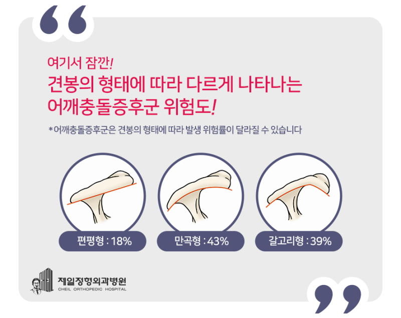 어깨충돌증후군 증상 및 8