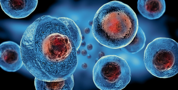 백혈병과 림프종 환자에서 73%의 반응성을 보인 CD19 CAR NK 세포치료제