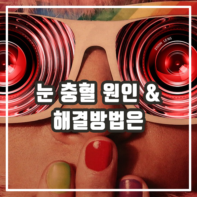  [서창동 안경] 눈 충혈 원인 / 안구실핏줄 원인은?