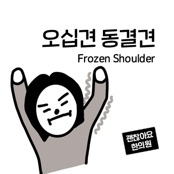 오십견의 치료는? 팔이 안올라가요. 유착성관절낭염 견관절주위염. 어깨가 아파요. 어깨통증 ④ 오십견의 치료는? 팔이 안올라가요. 유착성관절낭염 견관절주위염. 어깨가 아파요. 어깨통증 ④