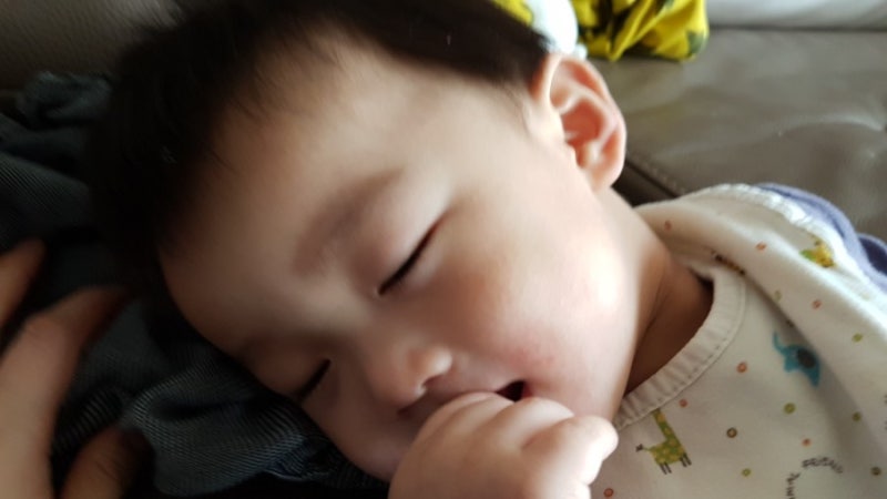 돌 이후 많이 좋아진 아기 얼굴 피부 (아토피/침구/피부염/보습제 리뷰) 4