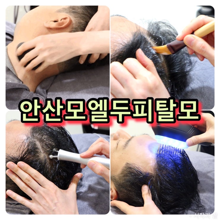  안산두피관리 [모엘탈모관리] 두피마사지 인생최고!강력추천각!