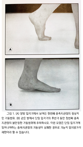  [신경계,근골격계] 기능적 엄지발가락(Functional hallux LIMITUS) 제한 확인하기