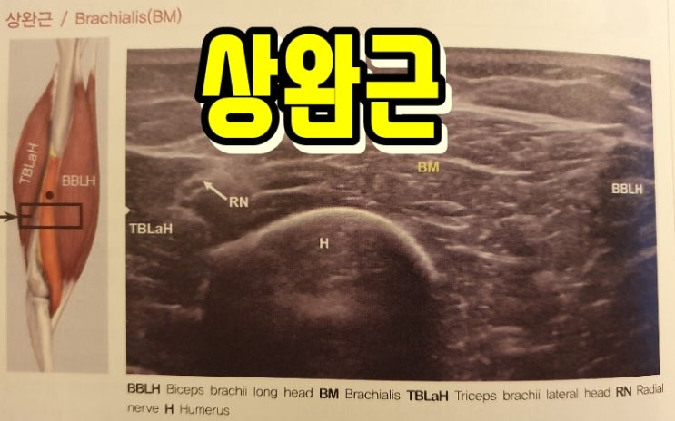  상완근 통증, Brachialis 위치