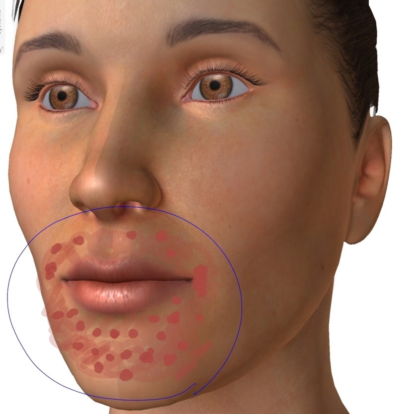 거무스름한 입 주위의 착색 걱정이라면 플라비코가 대답.