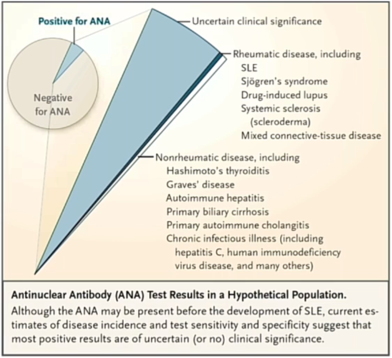 항핵항체 (ANA, Antinuclear antibodies) 의미, 항핵항체 양성일 경우 의미 및 추가 검사, 쇼그렌 증후군 ...