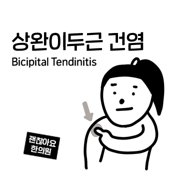 어깨 앞쪽이 아파요. 상완 이두근 건염의 증상과 치료. 어깨를 들 때 아파요. 어깨 통증 ⑤ 어깨 앞쪽이 아파요. 상완 이두근 건염의 증상과 치료. 어깨를 들 때 아파요. 어깨 통증 ⑤