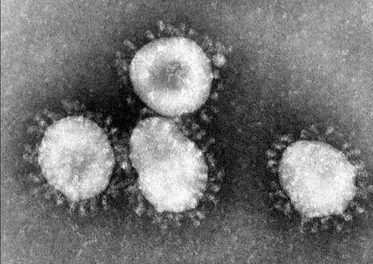 코로나19 감염증 우한폐렴 신종코로나바이러스 중국 사망자 일일 최대