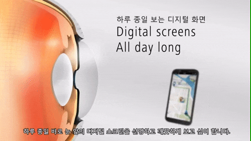  눈 떨림원인 : 미교정된 시력이 원인일 수 있습니다.