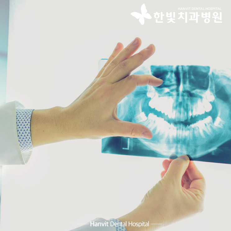  울산임플란트, 어디서 받을지 고민이라면?