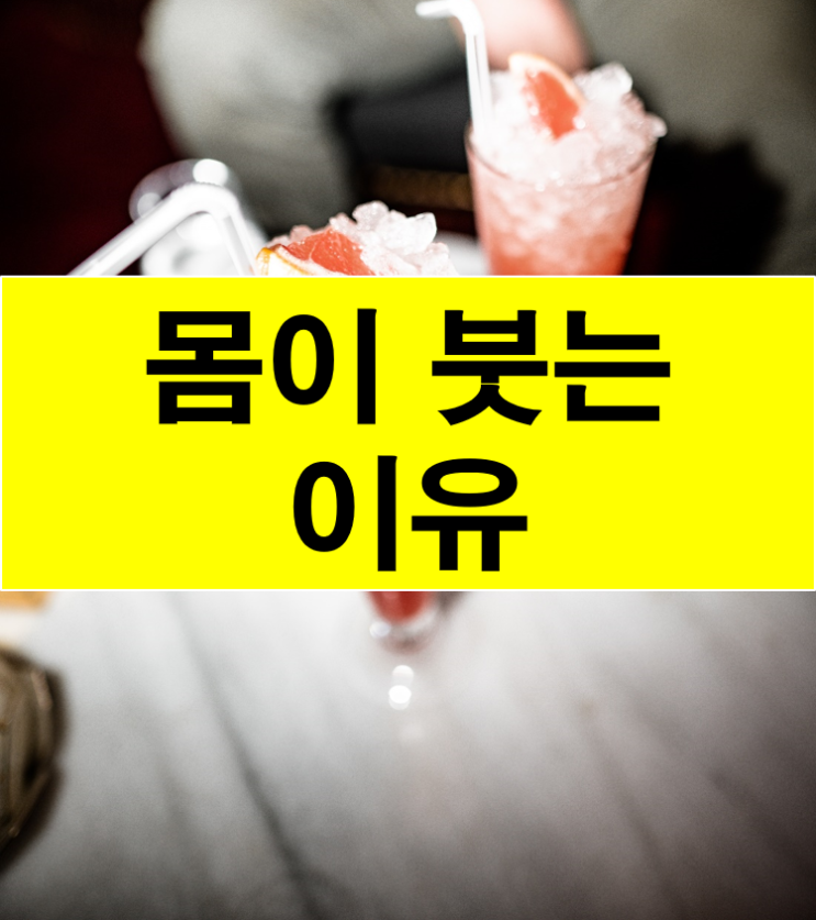  몸이 붓는 이유.