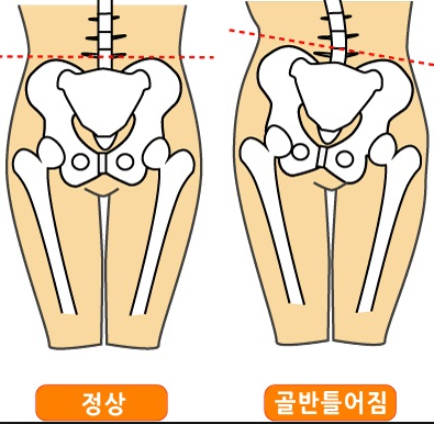  삐딱한 부모가 삐딱한 자녀로 키운다~~