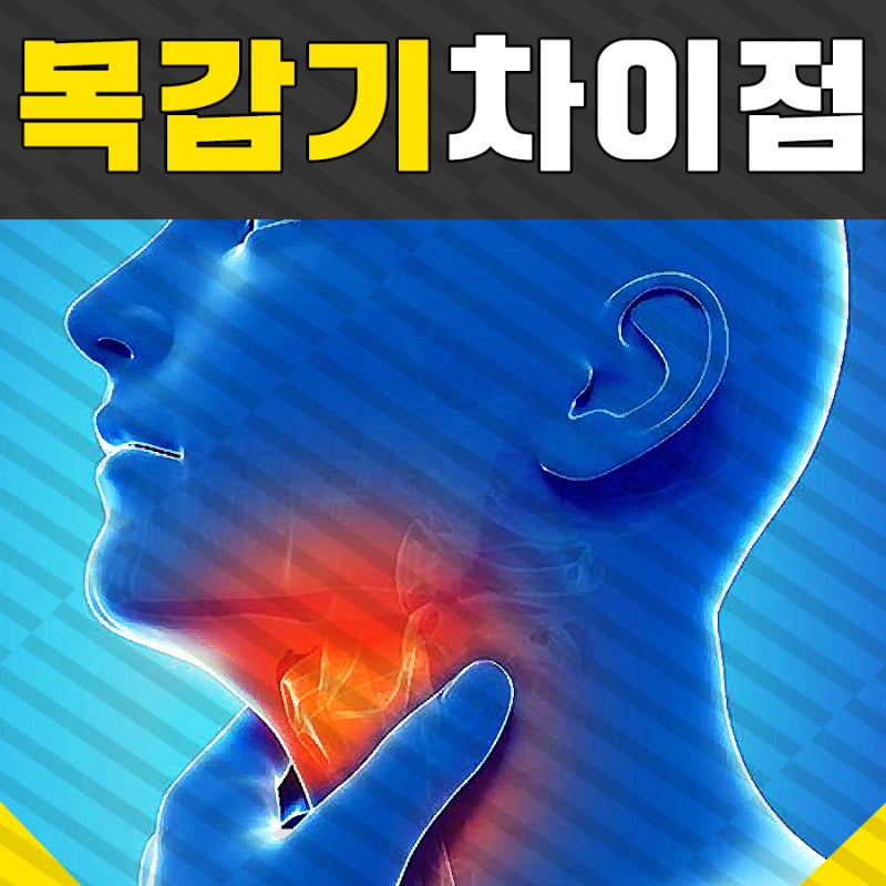 급성 인두염과 만성 인두염의 증상 비교 f. 역류성 인후염 7